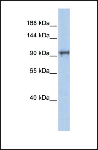 Anti-CCDC52, (N-terminal) antibody produced in rabbit