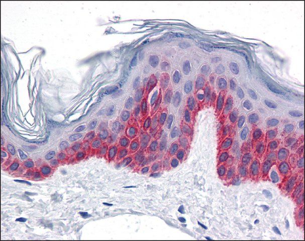 Anti-CCDC47 antibody produced in rabbit