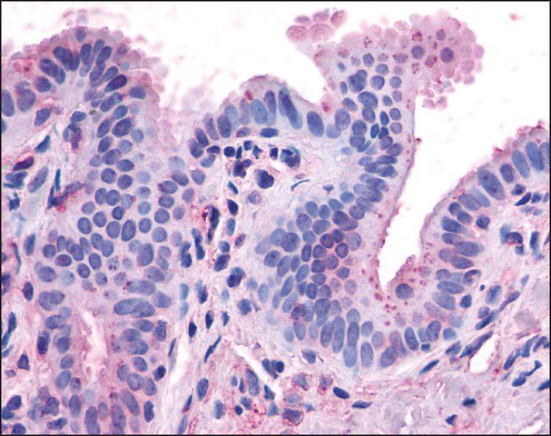 Anti-CCKAR antibody produced in rabbit