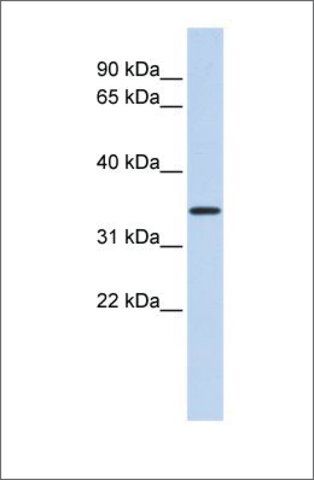 Anti-CCDC90A antibody produced in rabbit