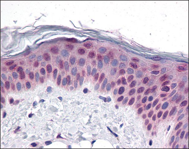 Anti-CCDC47 antibody produced in rabbit