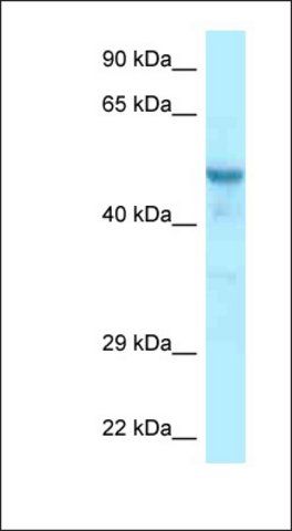 Anti-CCDC6 antibody produced in rabbit