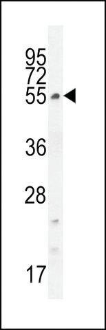 ANTI-CCDC61(N-TERMINAL) antibody produced in rabbit