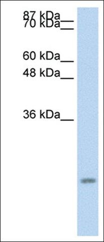 Anti-CCL13 antibody produced in rabbit