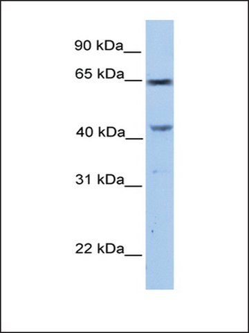 Anti-CCDC60 antibody produced in rabbit