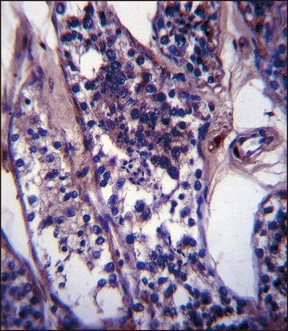 ANTI-CCDC99 (C-TERM) antibody produced in rabbit