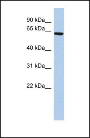 Anti-CCDC96, (N-terminal) antibody produced in rabbit