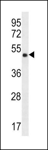 ANTI-CCDC71 (C-TERM) antibody produced in rabbit