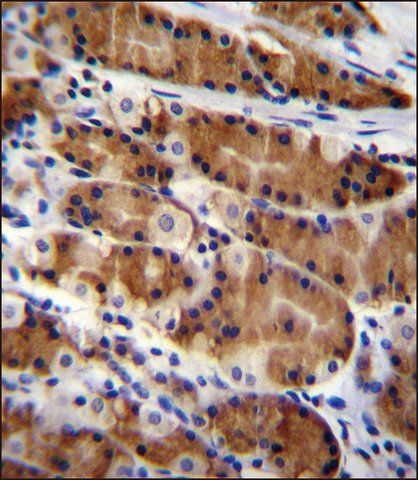 ANTI-CCDC84 (N-TERM) antibody produced in rabbit