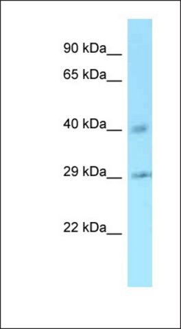 Anti-CCNJ antibody produced in rabbit