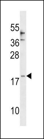 ANTI-CCL25 (CENTER) antibody produced in rabbit