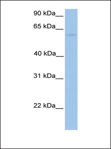 Anti-CCT6B antibody produced in rabbit