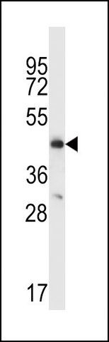 ANTI-CCR9 (C-TERM) antibody produced in rabbit