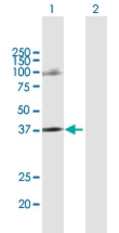 Anti-CCRL2 antibody produced in mouse