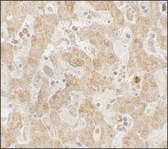 Anti-CCR7 antibody produced in rabbit