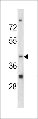 ANTI-CCRN4L(C-TERMINAL) antibody produced in rabbit