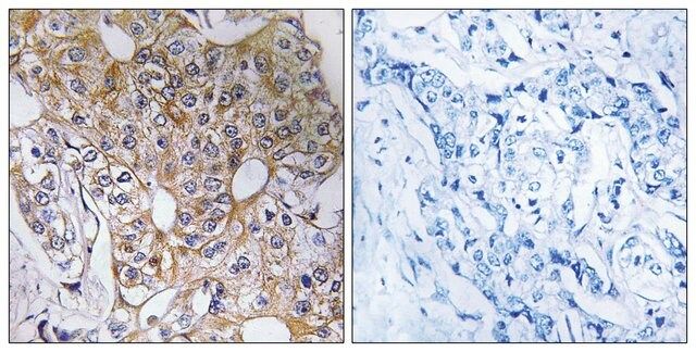 Anti-CCT6A antibody produced in rabbit