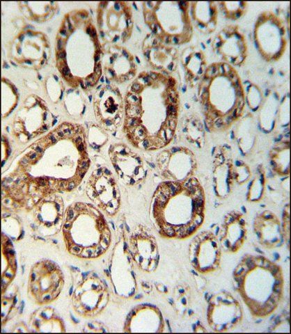 ANTI-CCR1 (N-TERM) antibody produced in rabbit