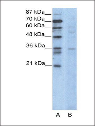 Anti-CCNB3 (AB1) antibody produced in rabbit