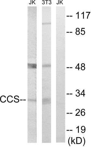 Anti-CCS antibody produced in rabbit