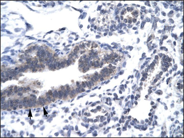 Anti-CCNH antibody produced in rabbit