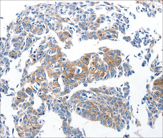 Anti-CCL6 antibody produced in rabbit