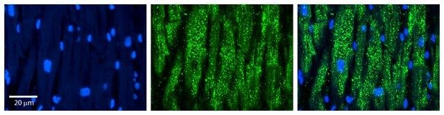 Anti-CCT5 (ab2) antibody produced in rabbit