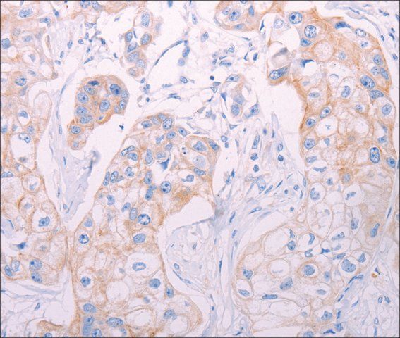 Anti-ADAMTS14 antibody produced in rabbit