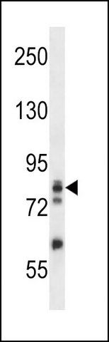 ANTI-ADD3 (C-TERM) antibody produced in rabbit