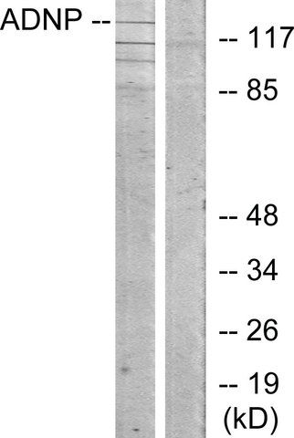 Anti-ADNP antibody produced in rabbit