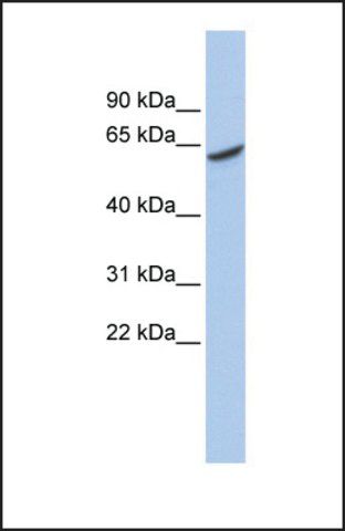 Anti-ADPGK antibody produced in rabbit