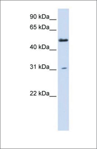 Anti-AGXT2L2 antibody produced in rabbit