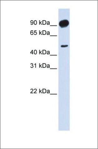 Anti-ADD2 antibody produced in rabbit