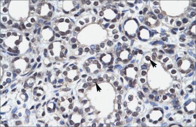 Anti-AIRE (AB2) antibody produced in rabbit