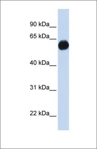 Anti-AKAP1 antibody produced in rabbit