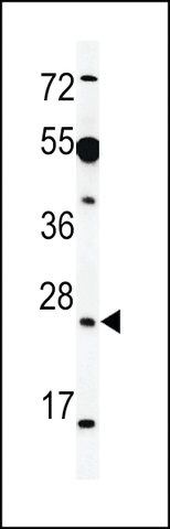 ANTI-AKIR1(C-TERMINAL) antibody produced in rabbit