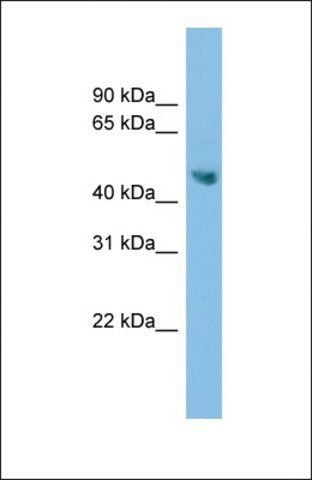 Anti-ADC antibody produced in rabbit