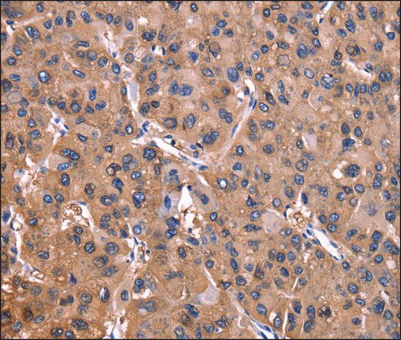 Anti-ADM2 antibody produced in rabbit