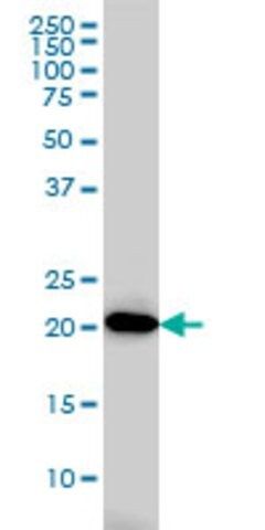 ANTI-AK1 antibody produced in mouse