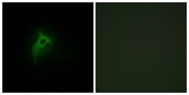 Anti-Adrenergic Receptor -2B antibody produced in rabbit