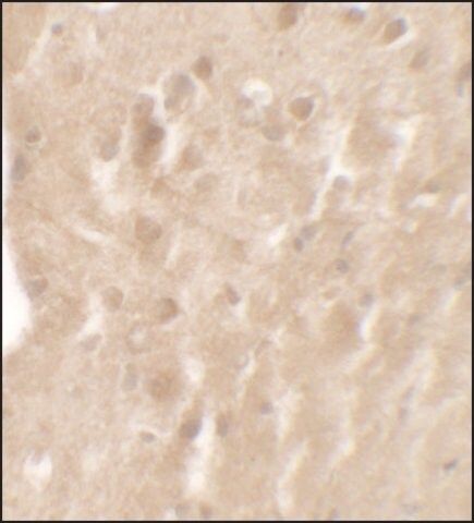 Anti-AIMP1 antibody produced in rabbit