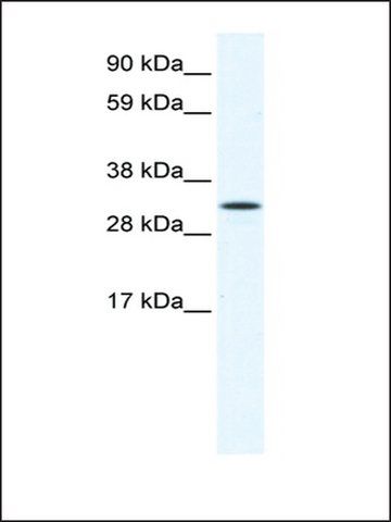 Anti-AIP (AB3) antibody produced in rabbit