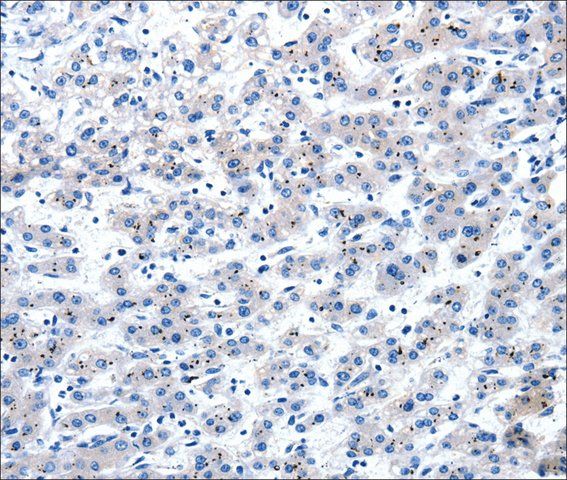 Anti-AIMP2 antibody produced in rabbit