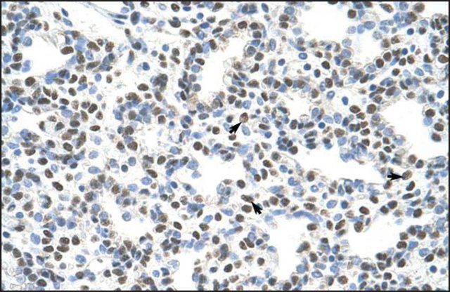 Anti-AKAP8L antibody produced in rabbit