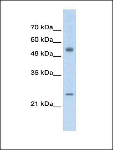 Anti-AK3L1 antibody produced in rabbit