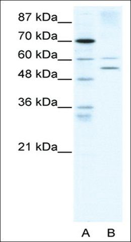 Anti-AIRE (AB1) antibody produced in rabbit