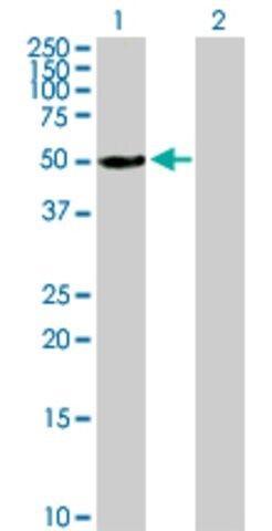 Anti-ALDH3A1 antibody produced in mouse