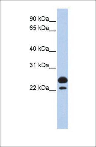 Anti-AK1 (ab2) antibody produced in rabbit