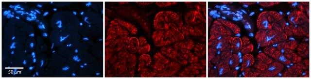 Anti-AKAP7 antibody produced in rabbit