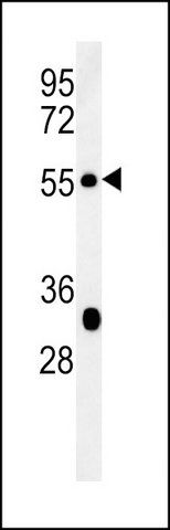 ANTI-ALDH8A1 (C-TERM) antibody produced in rabbit